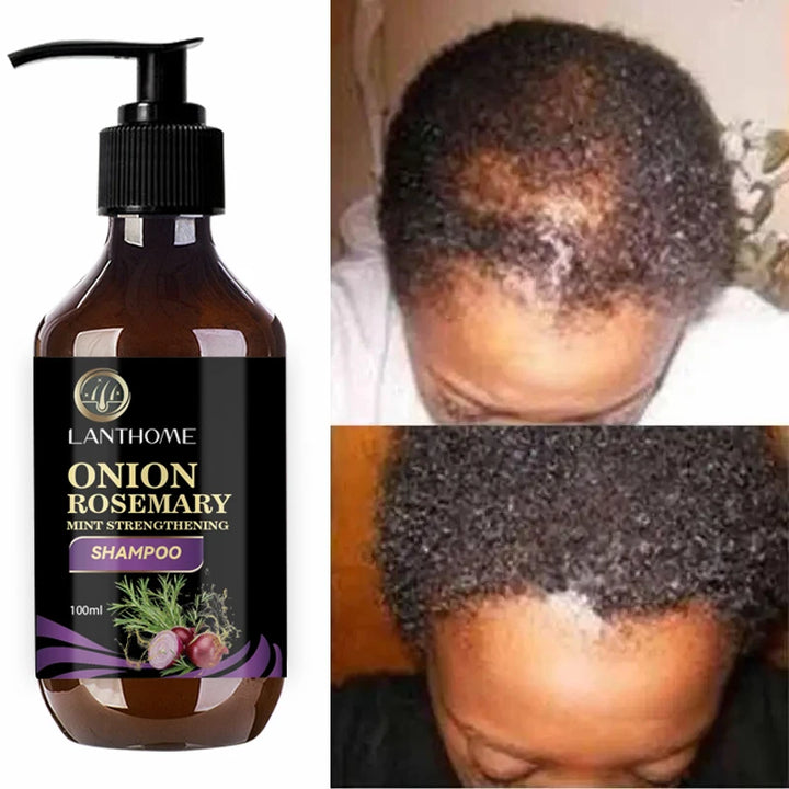 Shampoo for Fast Hair Growth